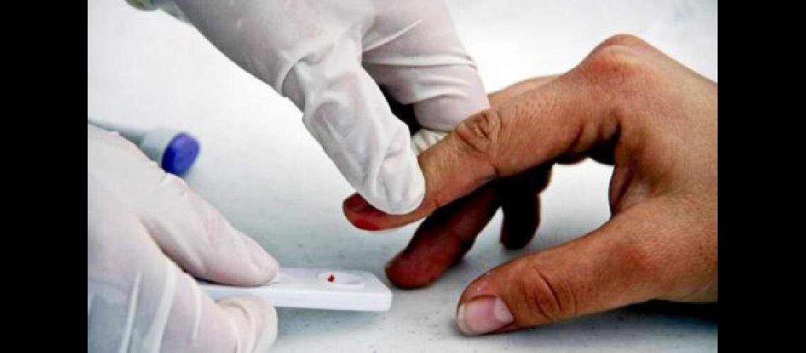 test hiv