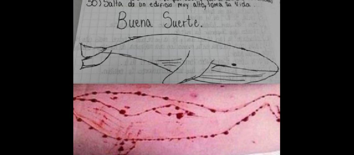 Un joven lucha por su vida  al jugar a la Ballena Azul