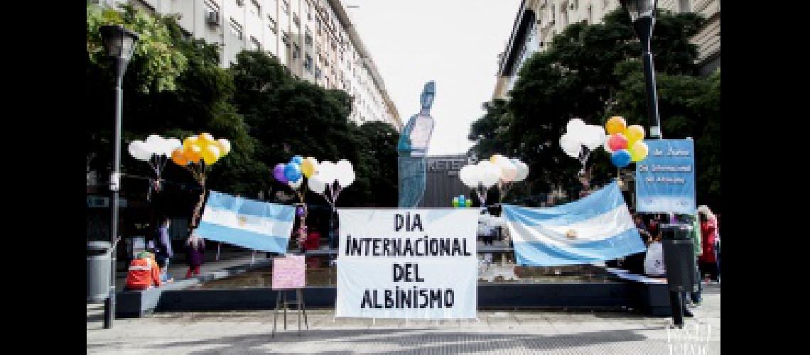 Albinismo- curiosidades discriminacioacuten y un proyecto de ley esperanzador