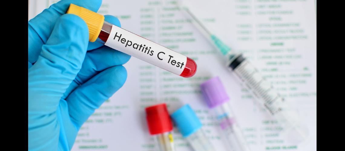 Hepatitis C- piden que la gente se haga el test