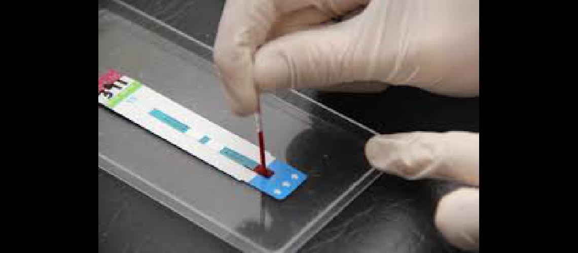 Test raacutepido de VIH en la Facultad de Derecho de Lomas