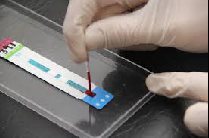Test raacutepido de VIH en la Facultad de Derecho de Lomas
