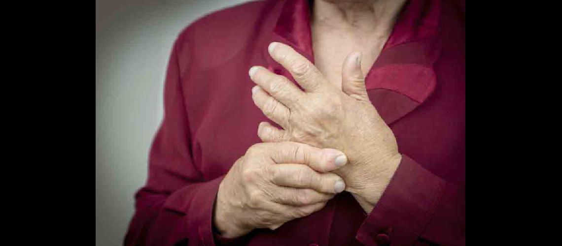 La artritis ya no se considera una enfermedad lenta y progresiva sino que es abordada como de raacutepida evolucioacuten