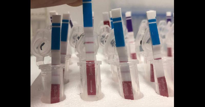 En el laboratorio del Hospital Gandulfo ya se analizan los test de diagnoacutestico raacutepido de Covid-19