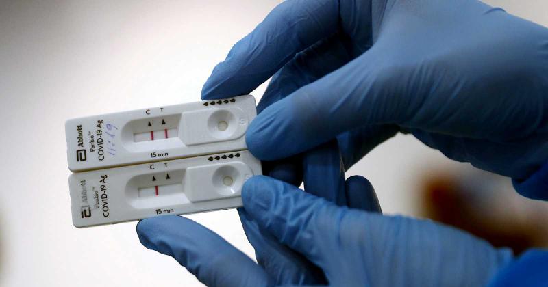 El Gobierno defendió la compra de los test de antígenos