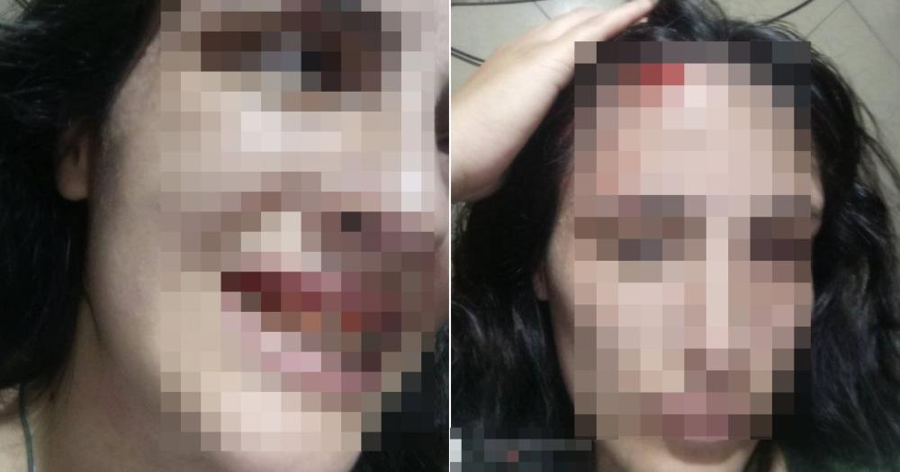 La joven atacada fue asistida por personal del SAME