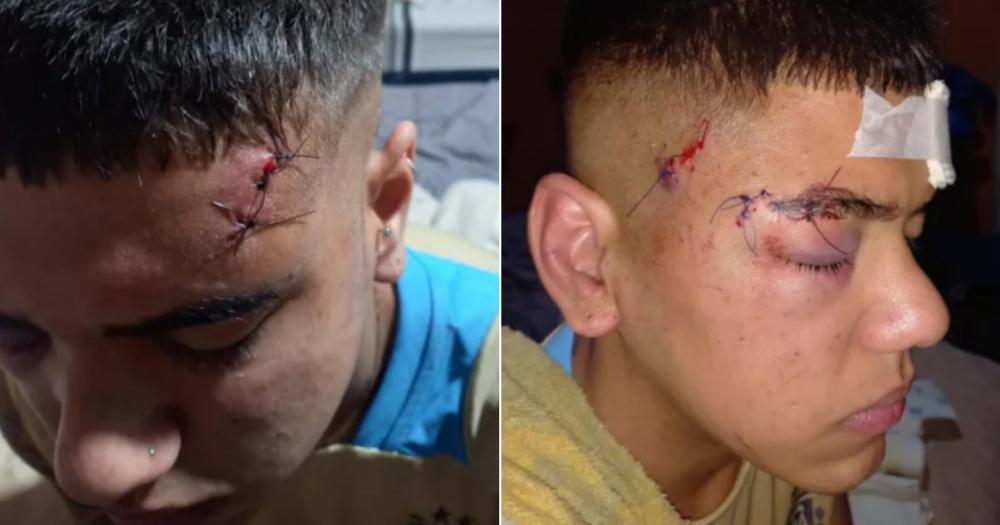 Las graves heridas que sufrió la víctima