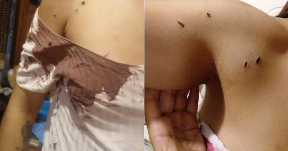 La joven atacada terminó ensangrentada con golpes en distintas partes del cuerpo
