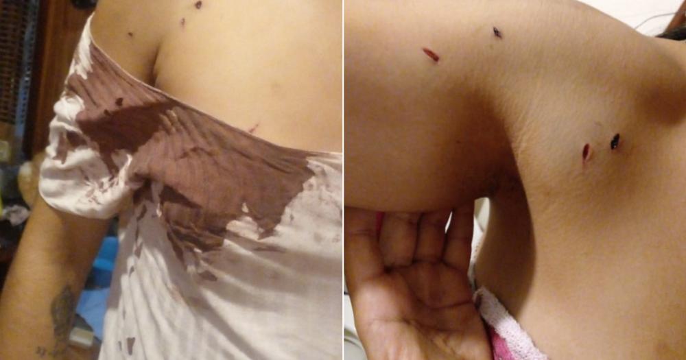 La joven atacada terminó ensangrentada con golpes en distintas partes del cuerpo
