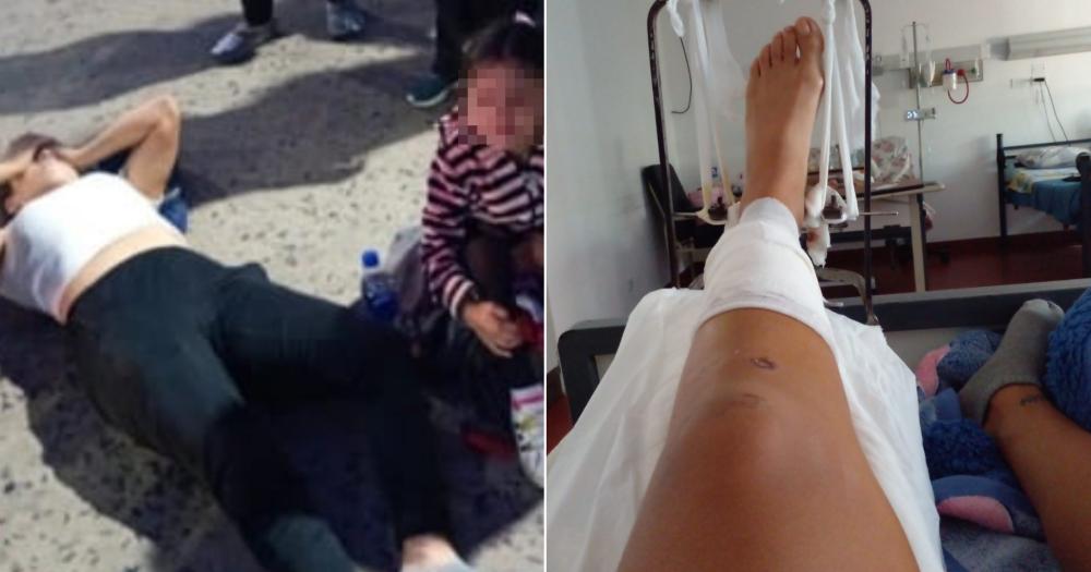 La menor no sufrió ninguna lesión pero la mujer tuvo una fractura expuesta