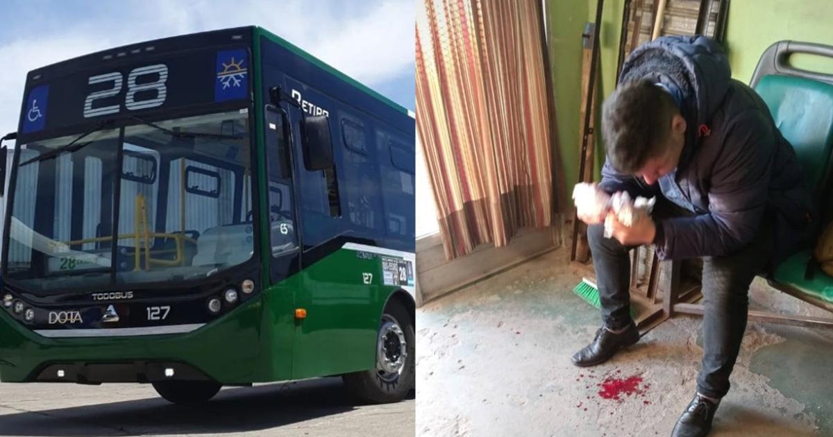 Un chofer de la línea 28 sufrió una brutal agresión